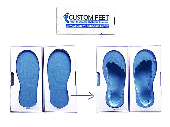 Custom Feet Dynamic Blue: Heat Moldable 
