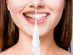 SweetWhite Professional Teeth Whitening Pen: 2-Pack
