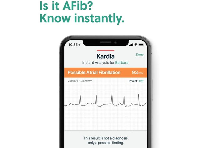 AliveCor 1141 KardiaMobile Personal EKG | FDA-Cleared | Detects AFib - Grey-- (Refurbished)