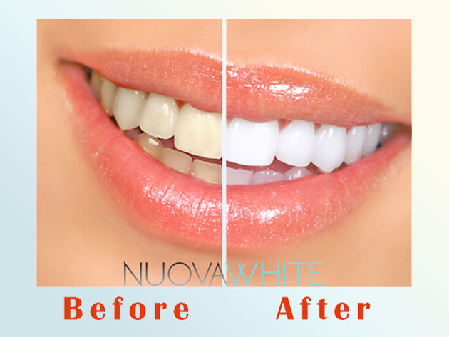 NUOVAWHITE Natural Activated Charcoal Teeth Whitening Powder: 2-Pack