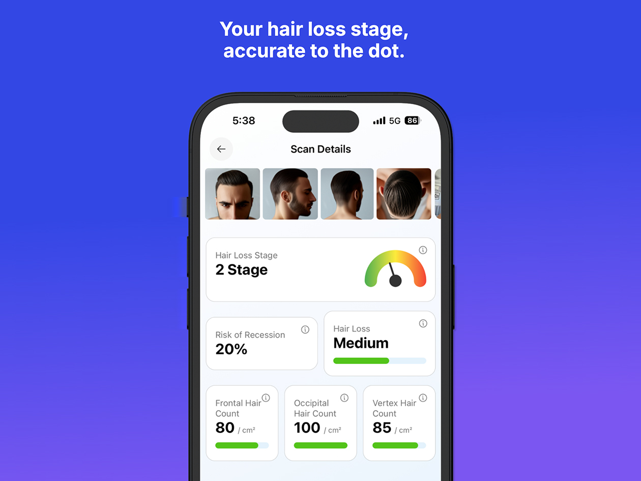 Hairmaxx AI Hair Analysis: Lifetime Subscription (iOS only)