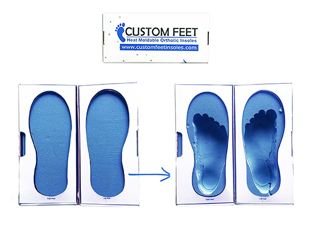 heat moldable orthotic insoles