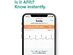AliveCor 1141 KardiaMobile Personal EKG | FDA-Cleared | Detects AFib - Grey-- (Refurbished)